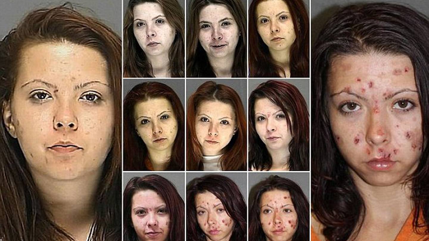 The Changing Faces Of Meth Addicts Wdbo